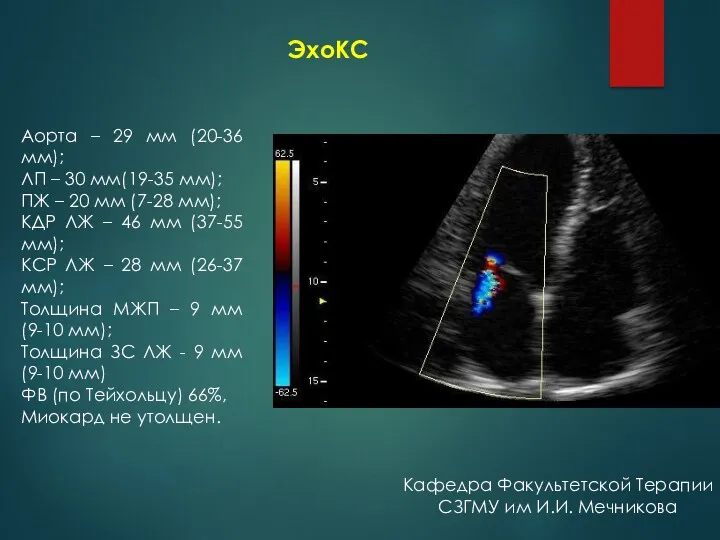 ЭхоКС Аорта – 29 мм (20-36 мм); ЛП – 30