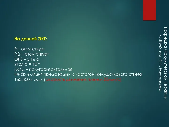 На данной ЭКГ: Р – отсутствует РQ – отсутствует QRS