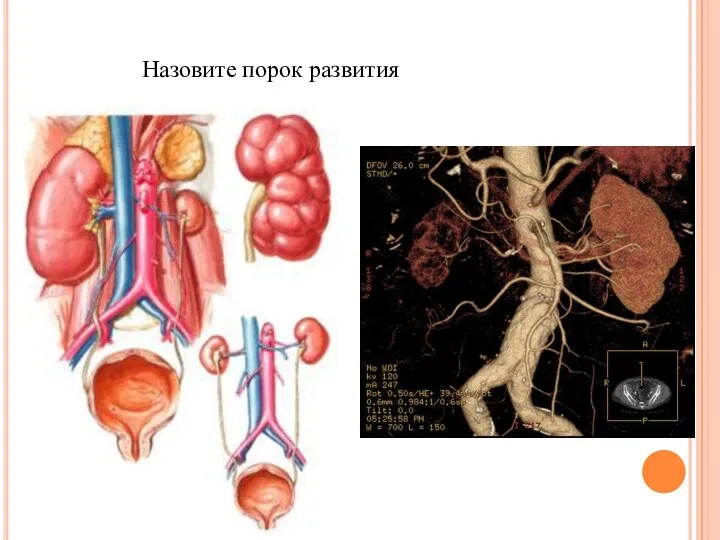 Назовите порок развития