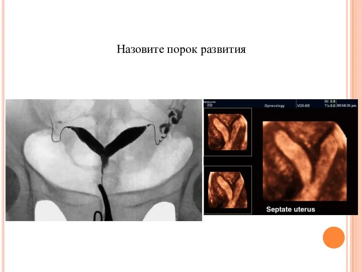 Назовите порок развития