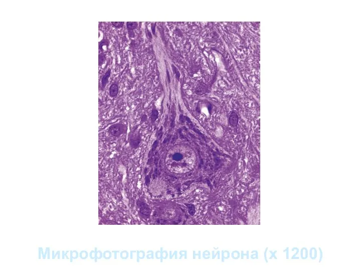 Микрофотография нейрона (х 1200)