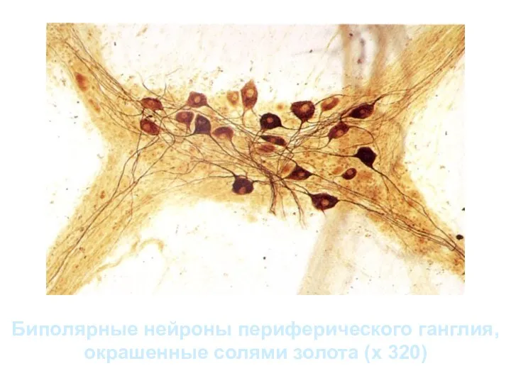 Биполярные нейроны периферического ганглия, окрашенные солями золота (х 320)