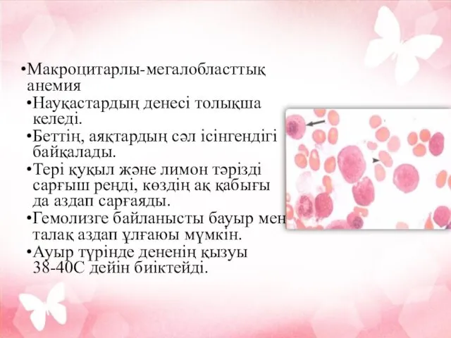 Макроцитарлы-мегалобласттық анемия Науқастардың денесі толықша келеді. Беттің, аяқтардың сәл ісінгендігі