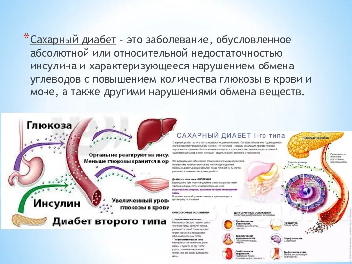 Сахарный диабет - это заболевание, обусловленное абсолютной или относительной недостаточностью