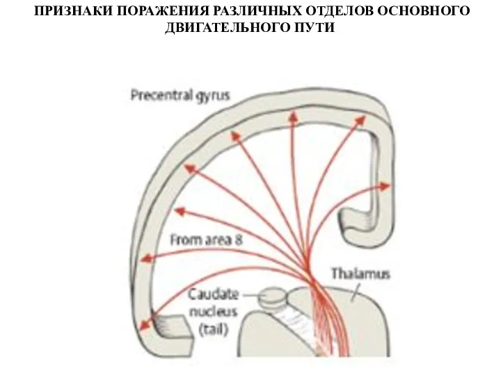 ПРИЗНАКИ ПОРАЖЕНИЯ РАЗЛИЧНЫХ ОТДЕЛОВ ОСНОВНОГО ДВИГАТЕЛЬНОГО ПУТИ