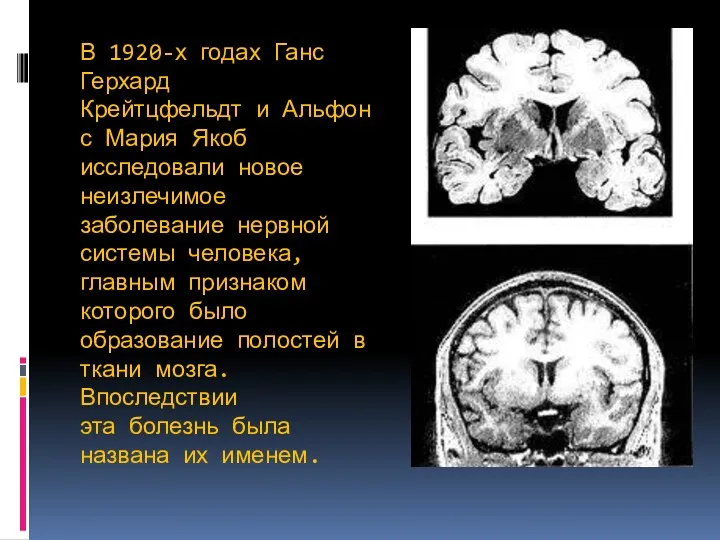 В 1920-х годах Ганс Герхард Крейтцфельдт и Альфонс Мария Якоб