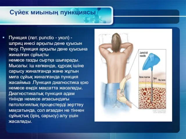 Сүйек миының пункциясы Пункция (лат. punctio - укол) - шприц