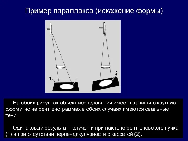 Пример параллакса (искажение формы) На обоих рисунках объект исследования имеет правильно круглую форму,