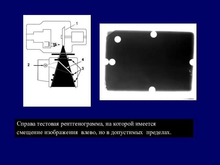 Справа тестовая рентгенограмма, на которой имеется смещение изображения влево, но в допустимых пределах.