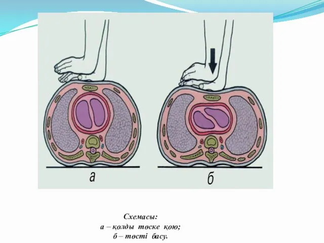 Схемасы: а – қолды төске қою; б – төсті басу.