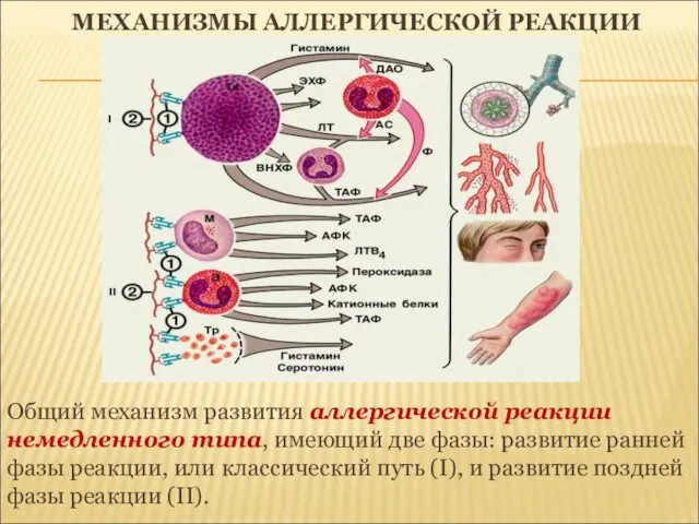 МЕХАНИЗМЫ АЛЛЕРГИЧЕСКОЙ РЕАКЦИИ Общий механизм развития аллергической реакции немедленного типа,