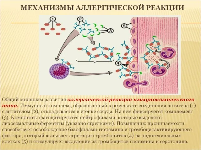 МЕХАНИЗМЫ АЛЛЕРГИЧЕСКОЙ РЕАКЦИИ Общий механизм развития аллергической реакции иммунокомплексного типа.