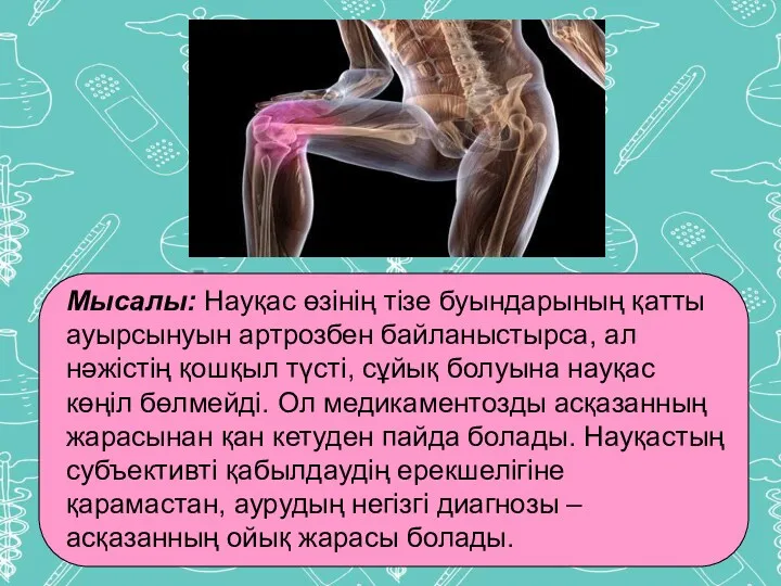 Мысалы: Науқас өзінің тізе буындарының қатты ауырсынуын артрозбен байланыстырса, ал