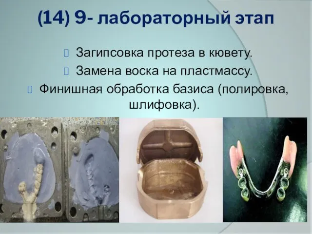 (14) 9- лабораторный этап Загипсовка протеза в кювету. Замена воска