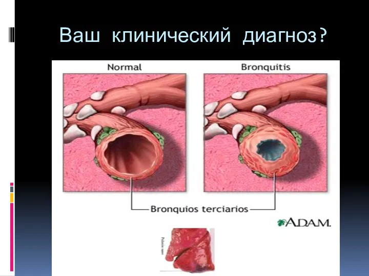 Ваш клинический диагноз?