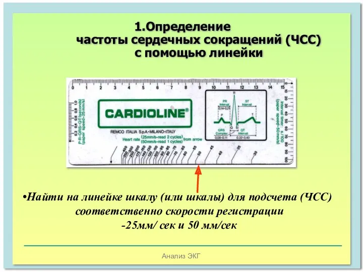 Анализ ЭКГ 1.Определение частоты сердечных сокращений (ЧСС) с помощью линейки