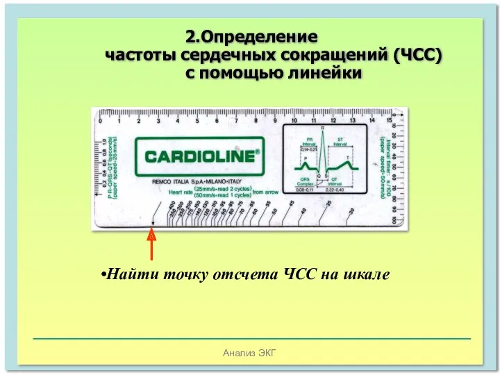 Анализ ЭКГ Найти точку отсчета ЧСС на шкале 2.Определение частоты сердечных сокращений (ЧСС) с помощью линейки