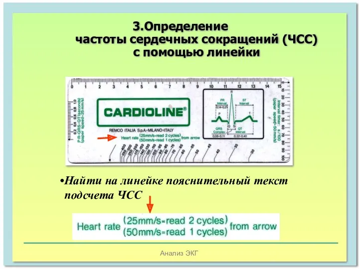 Анализ ЭКГ Найти на линейке пояснительный текст подсчета ЧСС 3.Определение