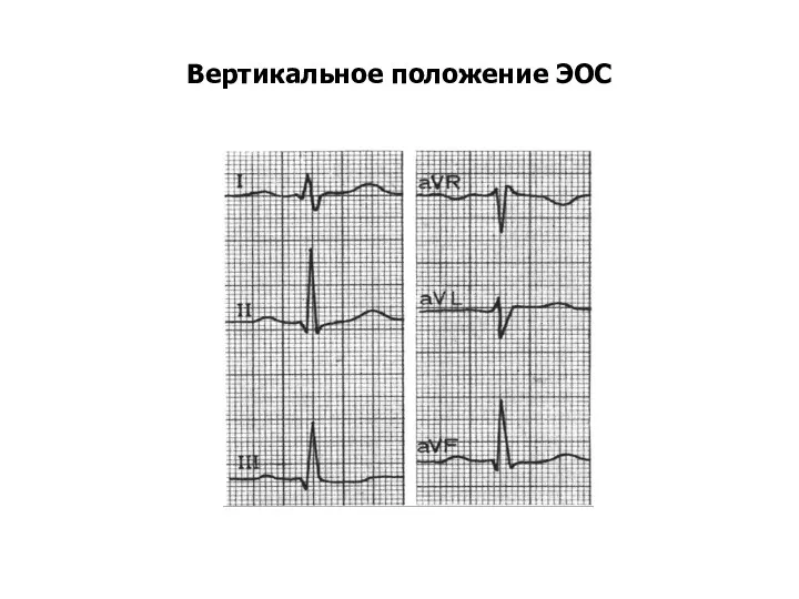 Вертикальное положение ЭОС