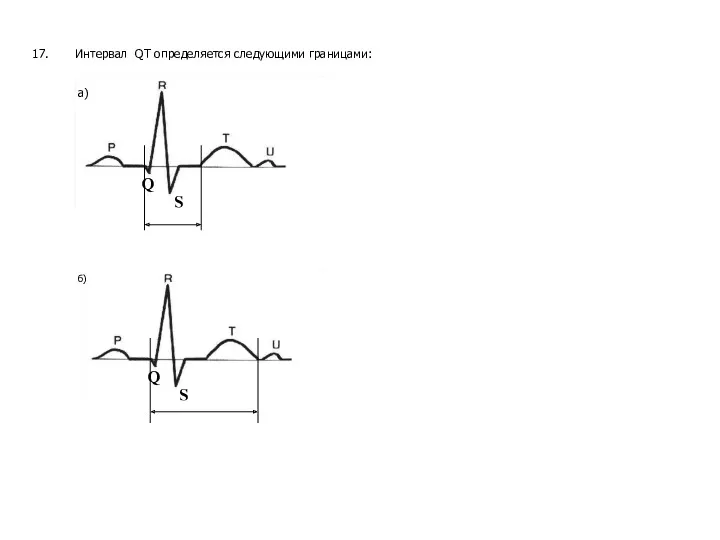 17. Интервал QT определяется следующими границами: а) б)