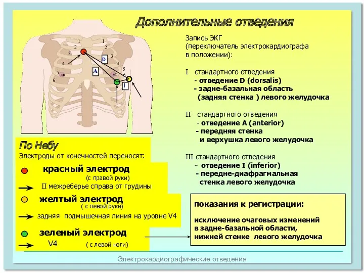 Электрокардиографические отведения 1 2 4 5 6 1 2 3