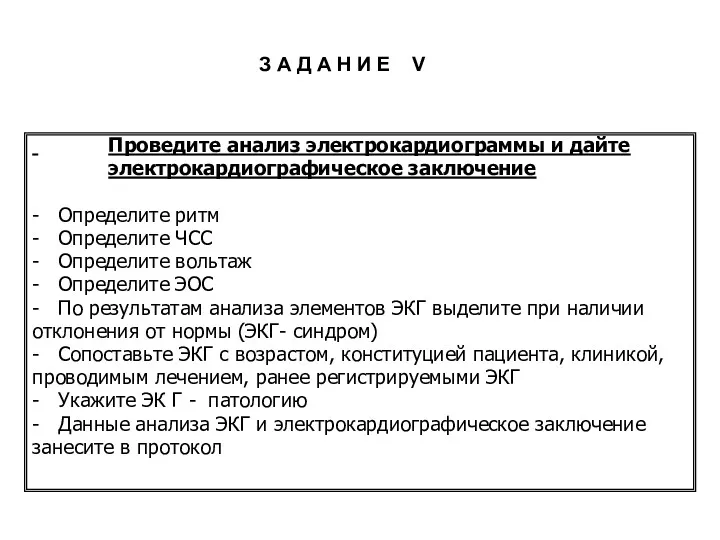 Проведите анализ электрокардиограммы и дайте электрокардиографическое заключение - Определите ритм