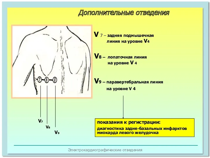 Электрокардиографические отведения V7 V8 V9 V 7 – задняя подмышечная