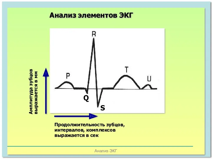 Анализ ЭКГ Анализ элементов ЭКГ Амплитуда зубцов выражается в мм