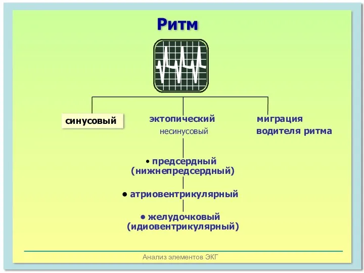 Анализ элементов ЭКГ эктопический миграция несинусовый водителя ритма предсердный (нижнепредсердный) атриовентрикулярный желудочковый (идиовентрикулярный) синусовый Ритм