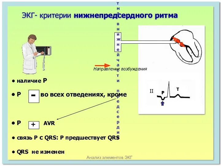 Анализ элементов ЭКГ ЭКГ- критерии нижнепредсердного ритма II P T