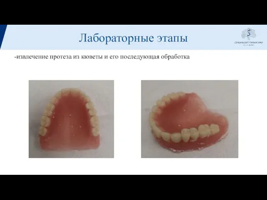 Лабораторные этапы -извлечение протеза из кюветы и его последующая обработка