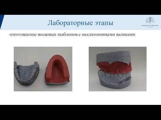 Лабораторные этапы -изготовление восковых шаблонов с окклюзионными валиками