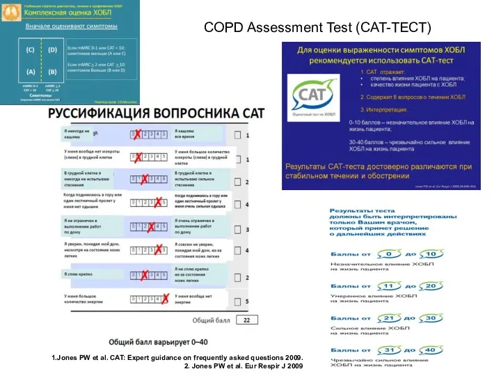 COPD Assessment Test (CAT-ТЕСТ) Jones PW et al. CAT: Expert