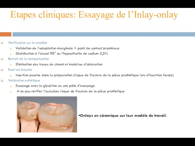 Etapes cliniques: Essayage de l’Inlay-onlay Vérification sur le modèle Validation