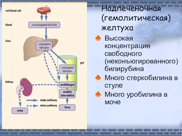 Высокая концентрация свободного (неконъюгированного) билирубина Много стеркобилина в стуле Много уробилина в моче Надпеченочная (гемолитическая) желтуха