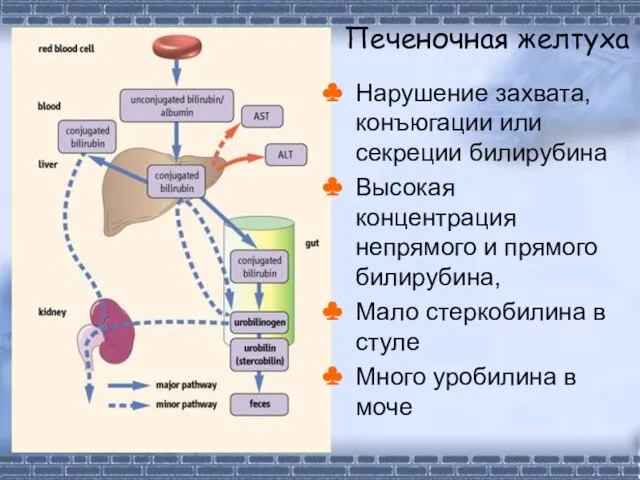 Печеночная желтуха Нарушение захвата, конъюгации или секреции билирубина Высокая концентрация