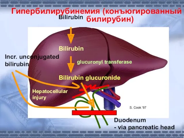 Duodenum - via pancreatic head Гипербилирубинемия (конъюгированный билирубин) Hepatocellular injury