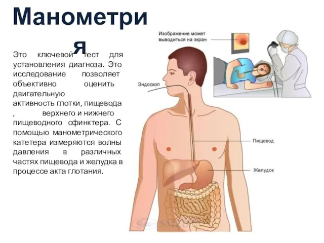 Манометрия Это ключевой тест для установления диагноза. Это исследование позволяет объективно оценить двигательную