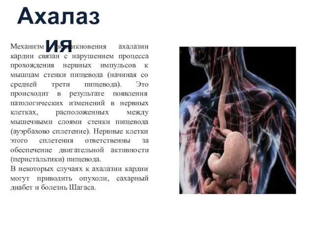 Ахалазия Механизм возникновения ахалазии кардии связан с нарушением процесса прохождения нервных импульсов к