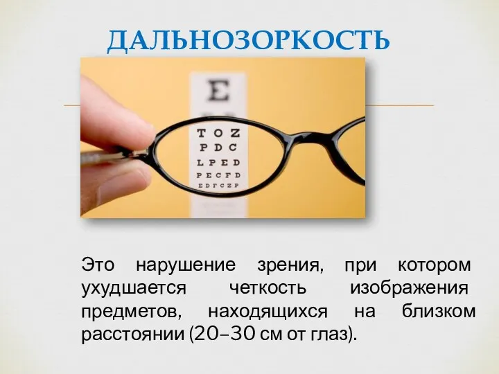 ДАЛЬНОЗОРКОСТЬ Это нарушение зрения, при котором ухудшается четкость изображения предметов, находящихся на близком