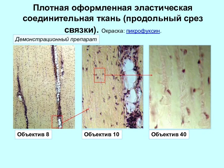 Плотная оформленная эластическая соединительная ткань (продольный срез связки). Окраска: пикрофуксин. Объектив 8 Объектив