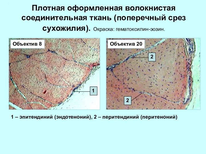 Плотная оформленная волокнистая соединительная ткань (поперечный срез сухожилия). Окраска: гематоксилин-эозин.