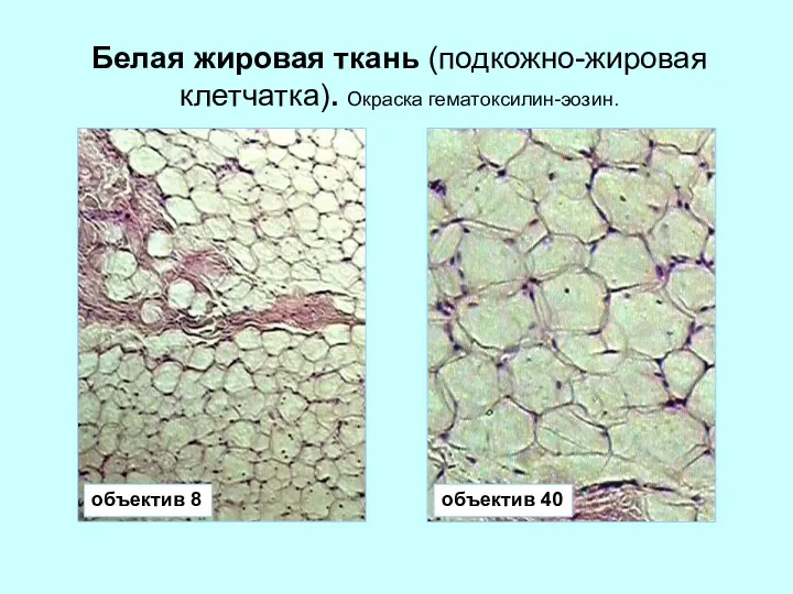 Белая жировая ткань (подкожно-жировая клетчатка). Окраска гематоксилин-эозин. объектив 8 объектив 40