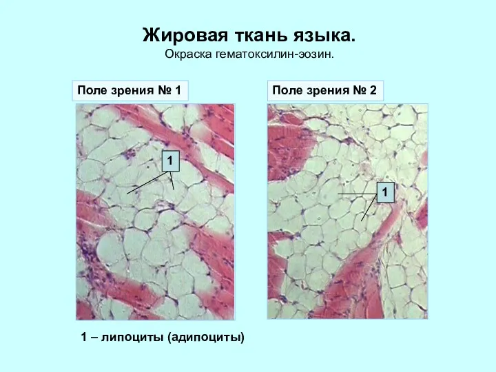 Жировая ткань языка. Окраска гематоксилин-эозин. Поле зрения № 1 Поле зрения № 2