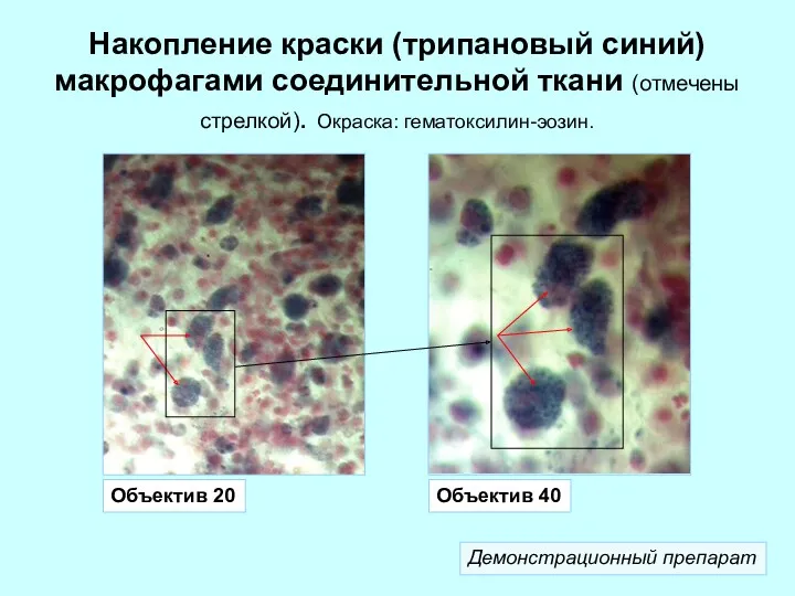 Накопление краски (трипановый синий) макрофагами соединительной ткани (отмечены стрелкой). Окраска: гематоксилин-эозин. Объектив 20