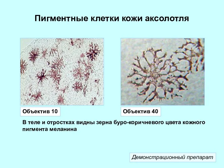 Пигментные клетки кожи аксолотля Объектив 10 Объектив 40 В теле и отростках видны