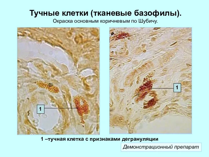 Тучные клетки (тканевые базофилы). Окраска основным коричневым по Шубичу. 1 –тучная клетка с