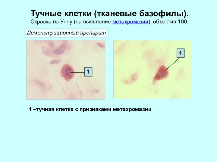 Тучные клетки (тканевые базофилы). Окраска по Унну (на выявление метахромазии), объектив 100. 1