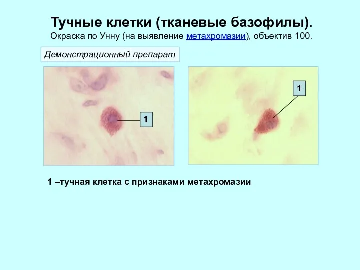 Тучные клетки (тканевые базофилы). Окраска по Унну (на выявление метахромазии),