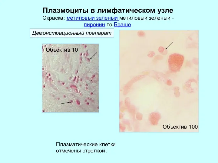 Плазмоциты в лимфатическом узле Окраска: метиловый зеленый метиловый зеленый -